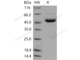 Recombinant Human SETD7/SET7/9 Protein (His Tag)