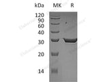 Recombinant Human 15-PGDH Protein (His Tag)(Active)