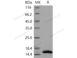 Recombinant Human CRABP2 Protein (His Tag)