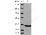 Recombinant Human CSRP1 Protein (His Tag)