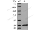 Recombinant Human PLA2G2A/PLA2B Protein (His Tag)