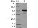 Recombinant Human REG4/RELP Protein (Fc Tag)