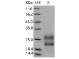 Recombinant Human RSPO3 Protein (aa 1-146, His Tag)(Active)