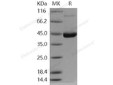 Recombinant Human ENTPD5 Protein (His Tag)(Active)