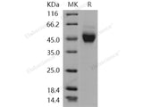 Recombinant Human NEGR1 Protein (His Tag)