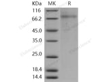 Recombinant Human PLTP Protein (His Tag)