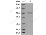 Recombinant Human GADD45A/DDIT-1 Protein (His & GST Tag)