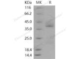 Recombinant Human CD69 Protein (aa 62-199, His Tag)