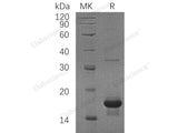 Recombinant Human SH2D1A/SAP Protein (His Tag)(Active) 