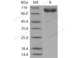 Recombinant Human NAALADL1 Protein (His Tag)