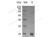 Recombinant Human S100A9 Protein (Active)