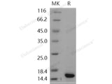 Recombinant Human S100A9 Protein (His Tag)(Active)