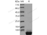 Recombinant Human S100A10 Protein (His Tag)