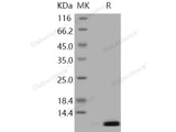 Recombinant Human S100A12/CAGC Protein (Active)