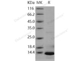 Recombinant Human S100A5 Protein (His Tag)