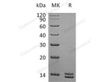 Recombinant Human S100A8 Protein (Baculovirus-Insect Cells, His Tag)(Active)