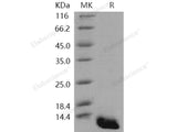 Recombinant Human S100A8 Protein (E.coli, His Tag)(Active)