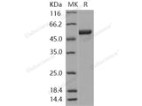 Recombinant Human S100A3/S100E Protein (His & MBP Tag)