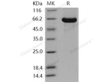 Recombinant Human AACS/Acetoacetyl-CoA Synthetase Protein (His Tag)