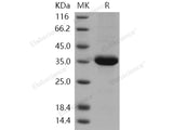 Recombinant Human ACBD6 Protein (His Tag)