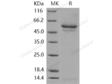 Recombinant Human SerpinI1/Neuroserpin Protein (His Tag)