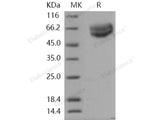 Recombinant Human IL18R1/CD218a Protein (His Tag)