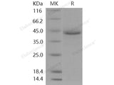 Recombinant Human LRPAP1/A2MRAP Protein (His Tag)(Active)