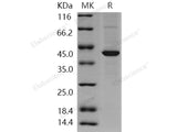 Recombinant Human ABHD4 Protein (His Tag)