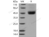 Recombinant Human SMYD2/KMT3C Protein (His Tag)