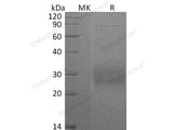 Recombinant Human CD74 Protein (His Tag)(Active)