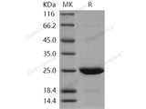 Recombinant Human cIAP1/HIAP2 Protein (AVI Tag)(Active)