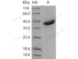 Recombinant Human R-Spondin 1/RSPO1 Protein (His Tag)(Active)