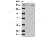 Recombinant Human AGO2/Argonaute 2/EIF2C2 Protein (His Tag)(Active)