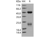 Recombinant Human Coagulation Factor X/F10 Protein (His Tag)