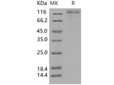 Recombinant Human VLDLR/VLDL Receptor Protein (His Tag)(Active)