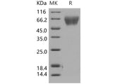 Recombinant Human TrkA/NTRK1 Protein (His Tag)