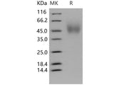 Recombinant Human TrkA/NTRK1 Protein (aa 194-413, His Tag)(Active)