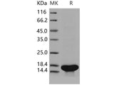 Recombinant Human TrkA/NTRK1 Protein (aa 285-413, His Tag)