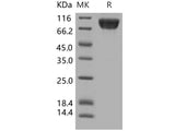 Recombinant Human TrkA/NTRK1 Protein (His & Fc Tag)(Active)