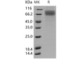 Recombinant Human SR-BI/CD36L1 Protein (His Tag)