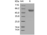 Recombinant Human Podoplanin/PDPN Protein (His & Fc Tag)(Active)