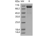 Recombinant Human LIMP-2/LIMPII Protein (His & Fc Tag)(Active)