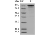 Recombinant Human TIM1/HAVCR1 Protein (His & Fc Tag)