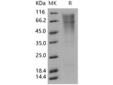 Recombinant Human TIM1/HACVR1 Protein (His Tag)