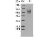 Recombinant Human CD16b/FCGR3B Protein (aa 1-200, His Tag)