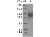 Recombinant Human CD16b/FCGR3B Protein (His Tag)