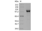 Recombinant Human PARP-1 Protein (His Tag)(Active)