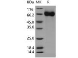 Recombinant Human CHST15/BRAG Protein (His Tag)