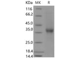 Recombinant Human CD8 beta/CD8B Protein (Fc Tag)