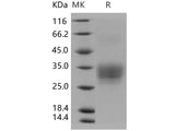 Recombinant Human CD7/GP40 Protein (His Tag)(Active)